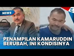 Rekan Sejawat Ungkap Perubahan Fisik Kamaruddin Simanjuntak, Soroti Perkembangan Kondisi Kesehatan Terkini
