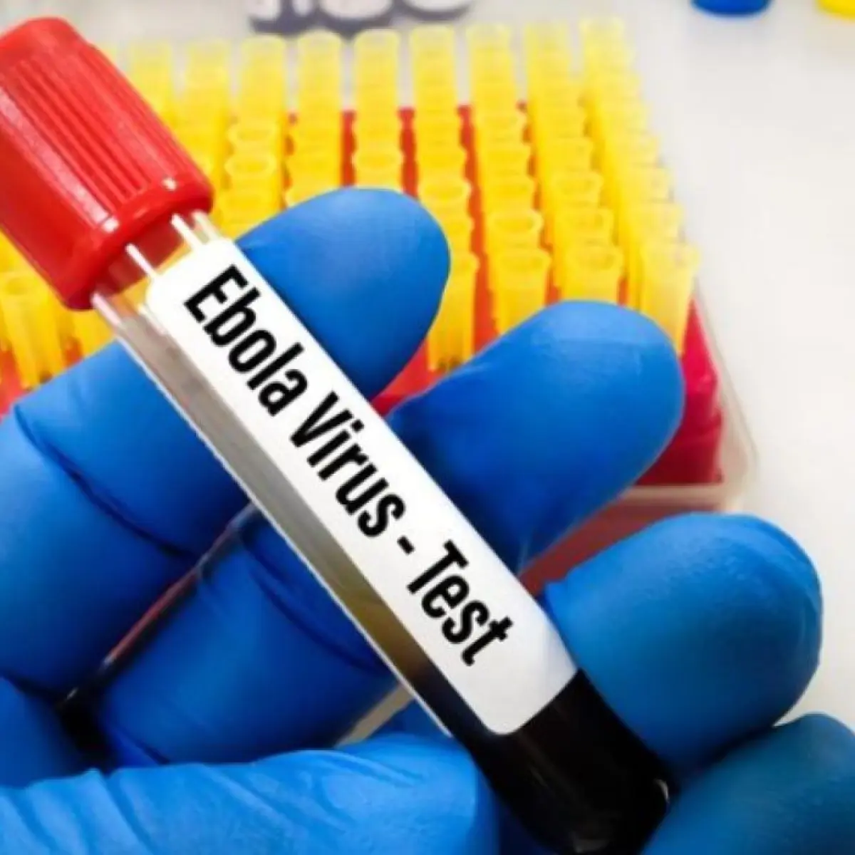 Wabah Hantavirus dan Ebola Jadi Peringatan Global: Ancaman Penyakit Zoonosis Kian Mendesak di Era Baru