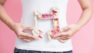 Foto: Ilustrasi kanker usus besar (Istock)