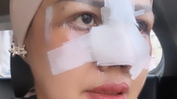 Elly Sugigi Ungkap Rahasia Kantongi Operasi Plastik Gratis, Nominal Fantastis Jika Berbayar