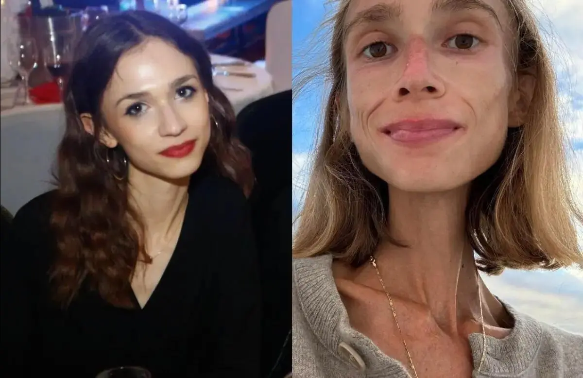 Tragedi di Bali: Ketika Diet Buah Berujung Maut