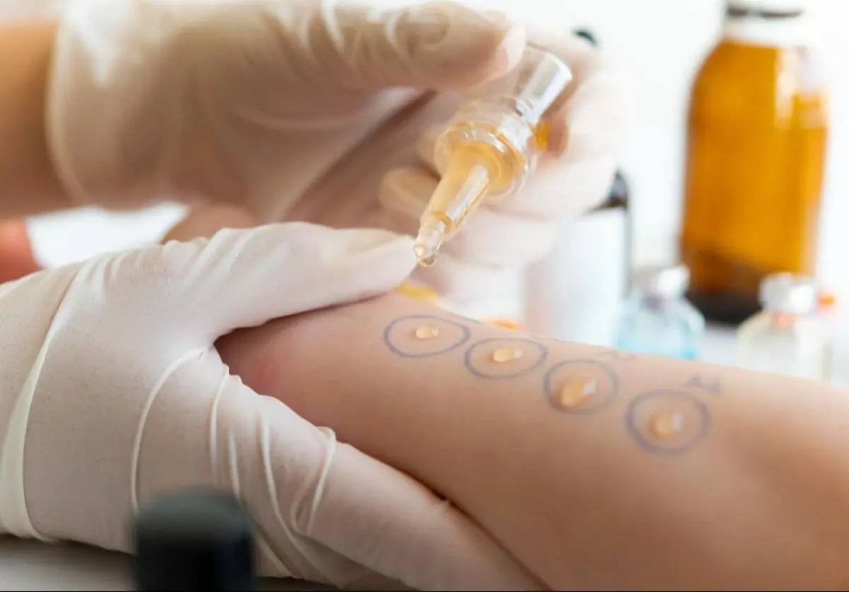 Jejak Alergi pada Anak: Mengurai Misteri, Merawat Harapan ala Pakar UGM