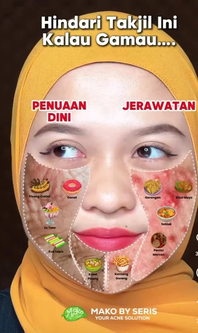 Waspada! Ini 5 Jenis Takjil Pemicu Jerawat dan Penuaan Dini yang Harus Dihindari